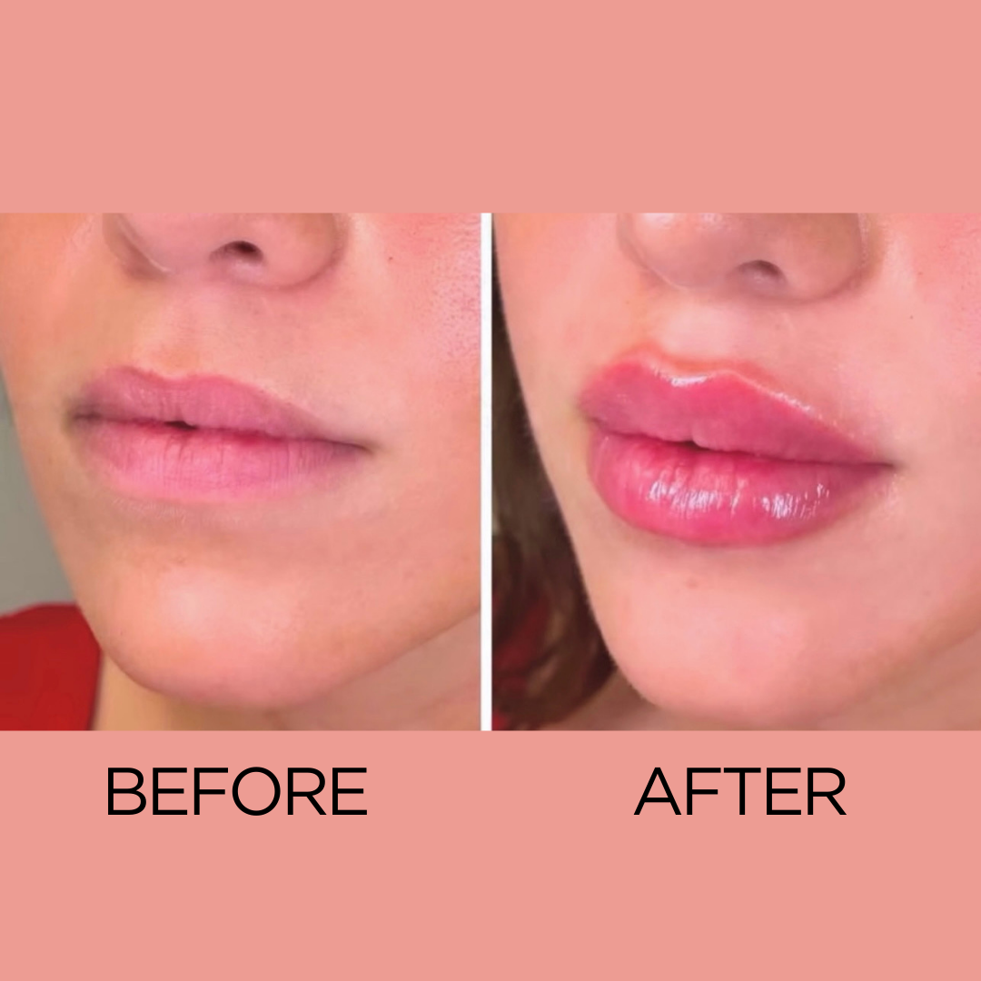 Hydrating Lip Plumping Gloss